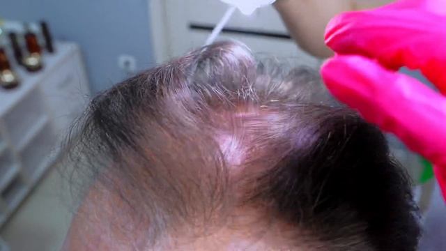 KEDMA Lux Hair профессиональный уход за волосами в Узбекистане! смотреть онлайн