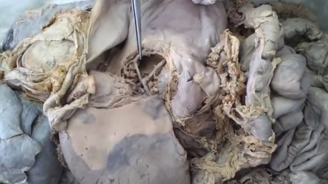 ветви грудной и брюшной частей аорты смотреть онлайн