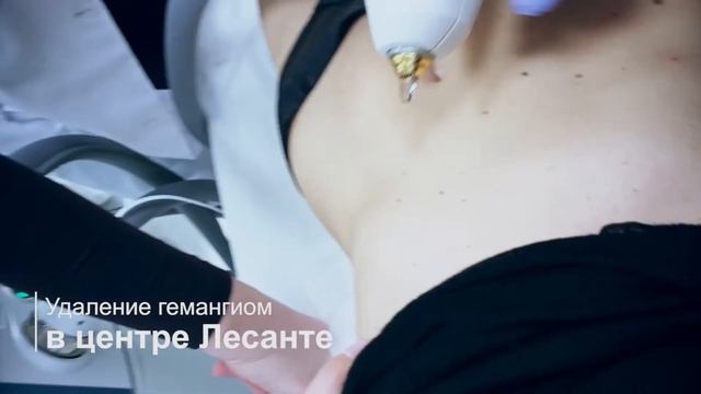 Удаление гемангиом смотреть онлайн
