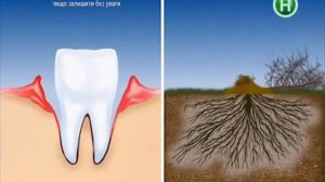 Українська реклама Parodontax (2015)