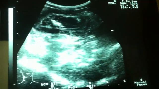 Кошка, гастрит инородный предмет в желудке смотреть онлайн