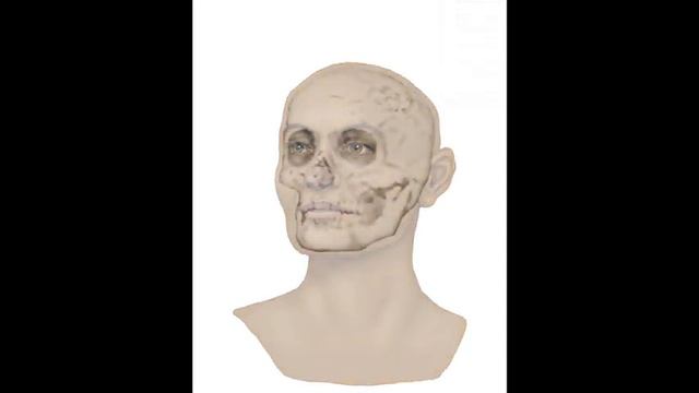 The Face Of A Vesuvius Victim (Artistic Reconstruction)
