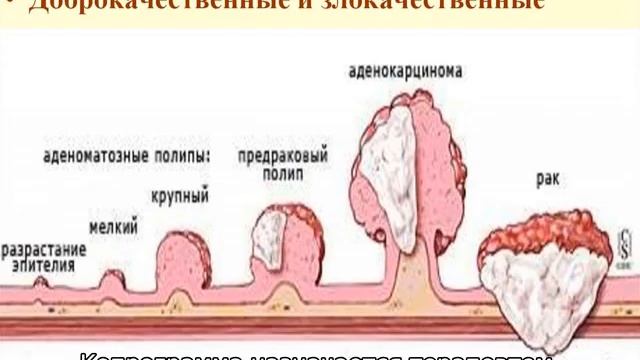 Непереваренные мышечные волокна в кале у ребенка в копрограмме смотреть онлайн