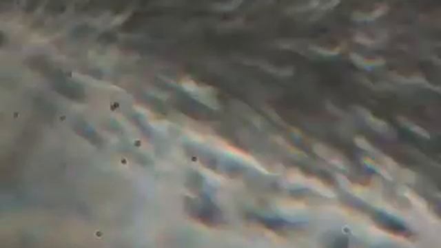 моя кровь под микроскопом смотреть онлайн