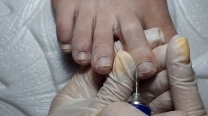 ?УБИРАЮ МОЗОЛЬ ПУШЕРОМ ?♀️? АППАРАТНЫЙ ПЕДИКЮР ❤