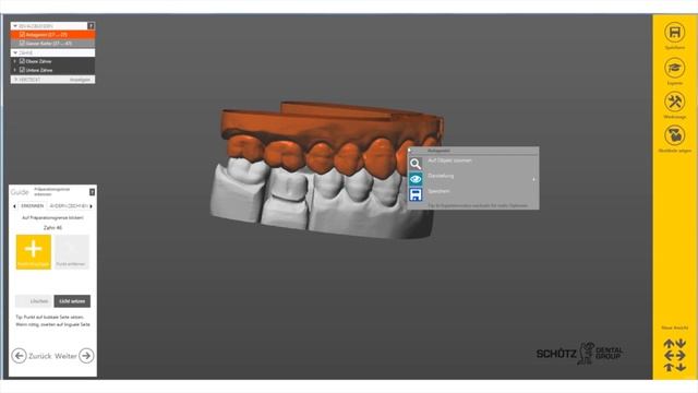 NEUE EXOCAD SOFTWARE 2015-CAD/CAM-Deutsch-Teaser-Modellation Offset Käppchen by Michael Anger смотреть онлайн