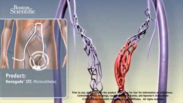 Вот Почему ОНАНИЗМ и МАСТУРБАЦИЯ ВРЕДНА, а ВОЗДЕРЖАНИЕ Полезно! смотреть онлайн