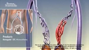 Вот Почему ОНАНИЗМ и МАСТУРБАЦИЯ ВРЕДНА, а ВОЗДЕРЖАНИЕ Полезно!