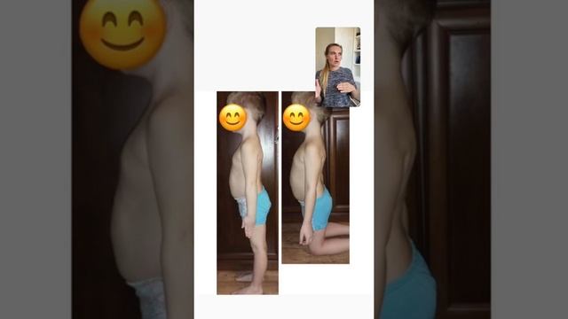 Как проверить осанку ребенка? смотреть онлайн