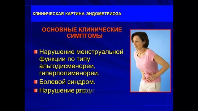 Эндометриоз смотреть онлайн