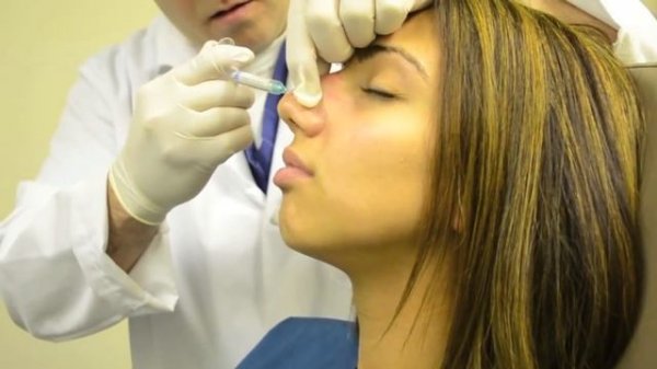 Контурная пластика носа (ринопластика)