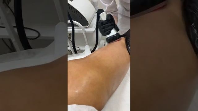 Вакуумный массаж смотреть онлайн