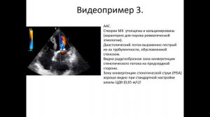 ОСНОВЫ ЭХОКАРДИОГРАФИИ: Митральная недостаточность