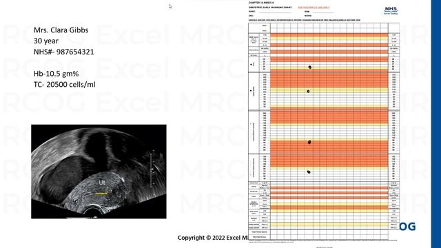 Post Operative Complications- Pelvic Inflammatory Disease смотреть онлайн