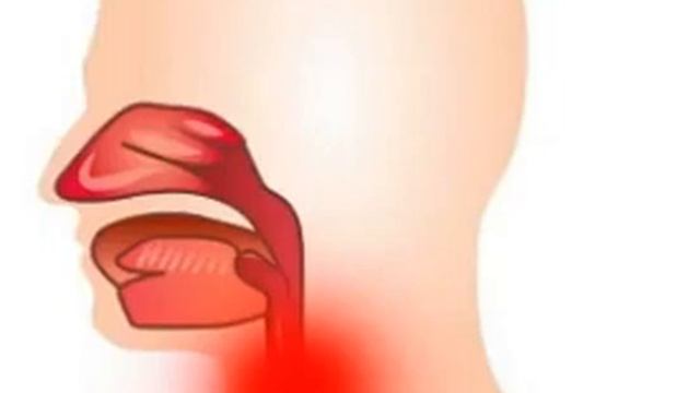 Ларинготрахеит