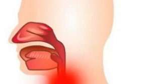 Ларинготрахеит