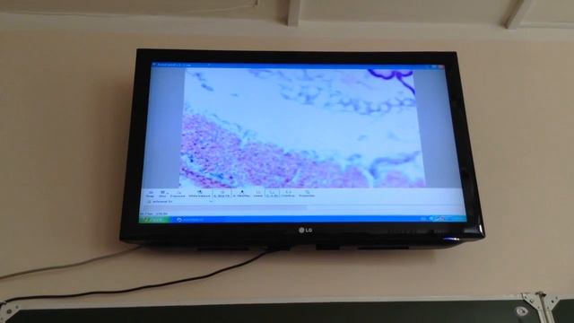 Гистология Пищевод [Пищеварительная система]