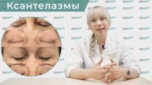 Удаление ксантелазмы