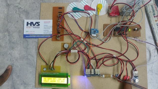 ICU patient health and Ambient parameters monitoring using Node MCU Max 30100 Mlx90614 ECG MEMS смотреть онлайн