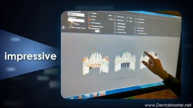 Dentalmaster Customisable 3D Patient Education on Touch Screen смотреть онлайн