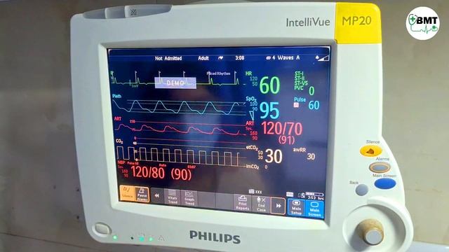 Philips Intellivue MP20 Patient Monitor | Overview | How to operate | Battery insertion | Full demo смотреть онлайн
