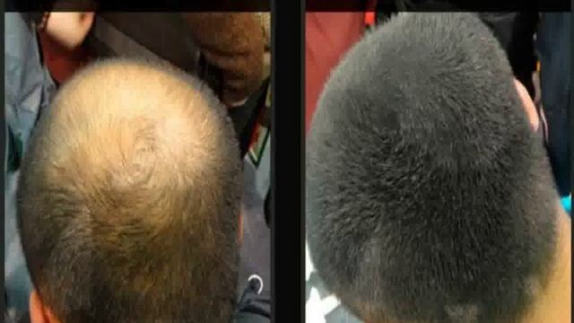 маска эстель для восстановления волос смотреть онлайн