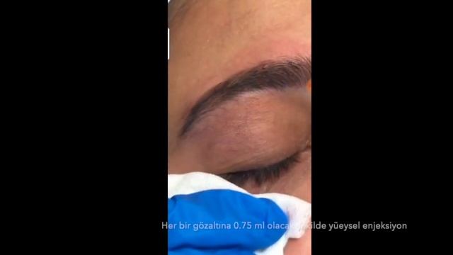 Dermaheal Dark Circle Solution Uygulamasi