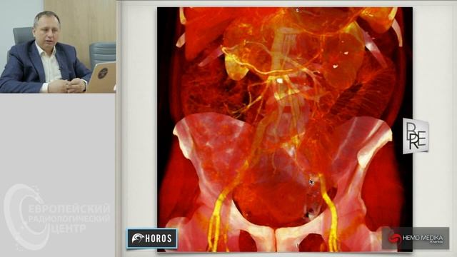 Часть 4. DICOM. Постпроцессинг. Артефакты на КТ - изображениях. Андрей Мангов смотреть онлайн