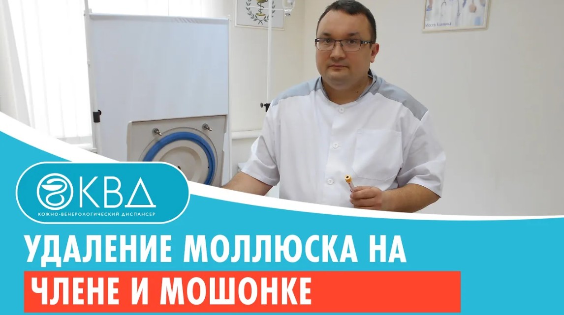 ✅ Удаление моллюска на члене и мошонке. Клинический случай №636 смотреть онлайн