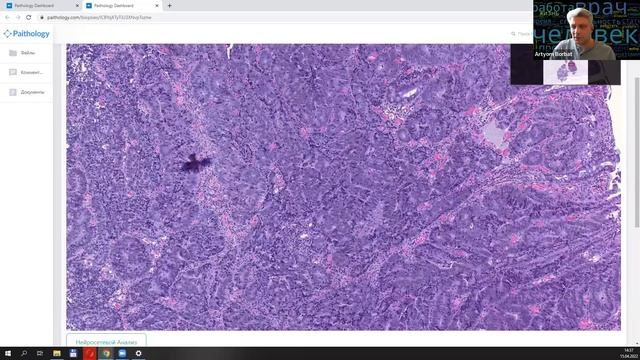 Анонс и приглашение в пилот смотреть онлайн