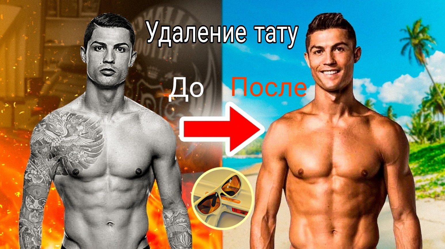 Удаление татуировки лазером от первого визита до чистой коже. Часть 1. смотреть онлайн