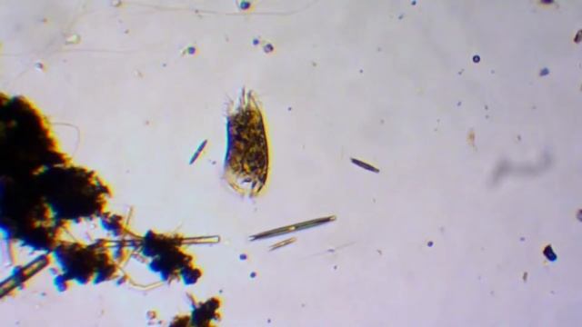 Рак излечим? Открытие ученых смотреть онлайн