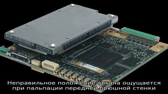 Что такое дистопия почки