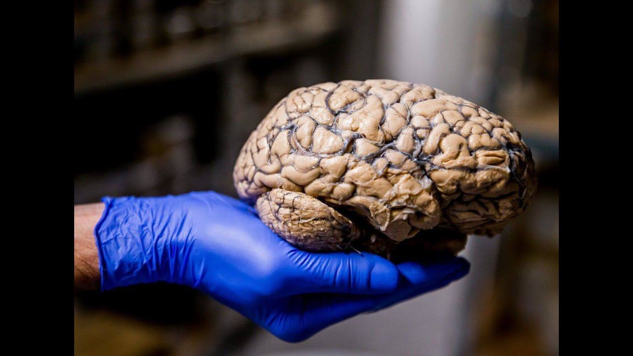 МОЗГ у ВСЕХ одинаков - УТОПИЯ !! (поясняет Сергей Савельев)