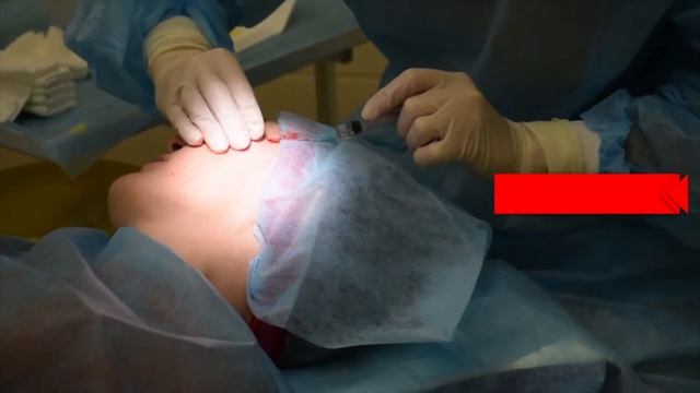 Нитевой лифтинг АПТОС (APTOS). Клиника "ВиАнта", Курск смотреть онлайн