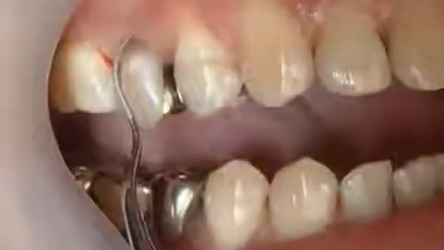 Varios 970 LUX - автономный ультразвуковой скалер, 2 ёмкости, с оптикой | NSK Nakanishi (Япония) смотреть онлайн