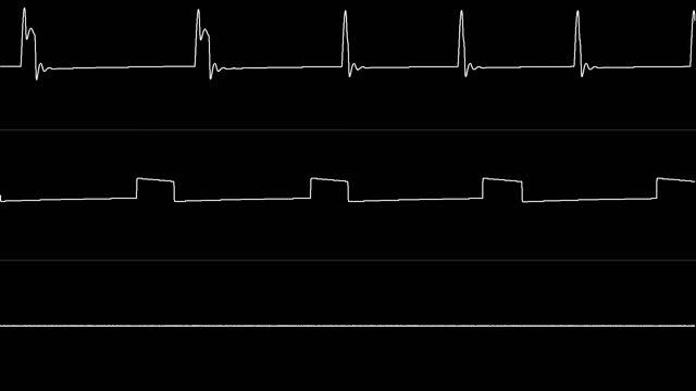 Matt Gray - "Deliverance: Stormlord 2 (C64)" [Oscilloscope View] смотреть онлайн