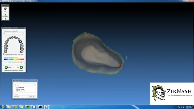 Origin/Medit Identica Exocad Crown Bicuspid @ Nash Dental Lab смотреть онлайн