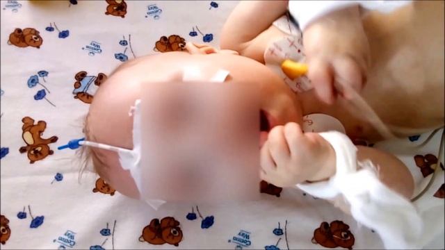 Миоклонус смотреть онлайн