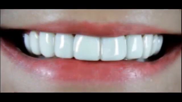 Snap on smile смотреть онлайн