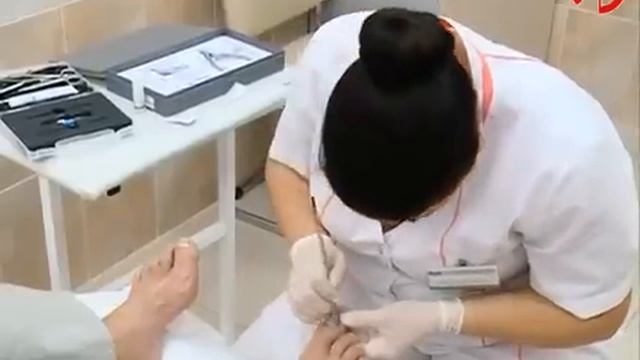 Лечение вросшего ногтя скобой (пластиной) смотреть онлайн