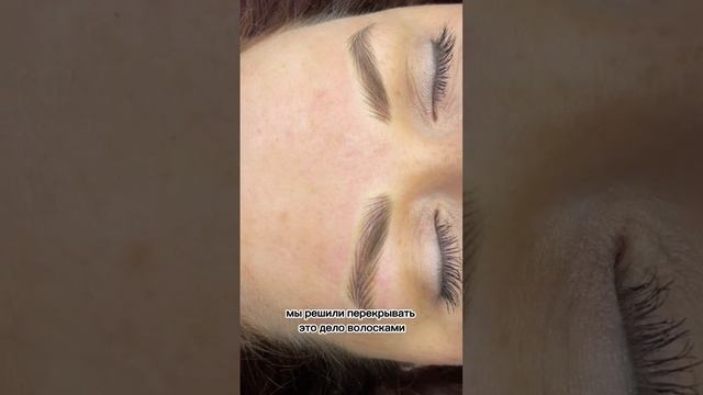 Волосковая техника на шрамированой коже. Результат в конце видео? смотреть онлайн