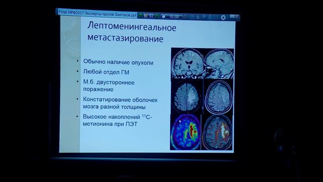 Скворцова Т.Ю. - Мультимодальная нейровизуализация: эксперты против знатоков смотреть онлайн