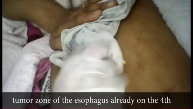cancer treatment method with english subtitles смотреть онлайн