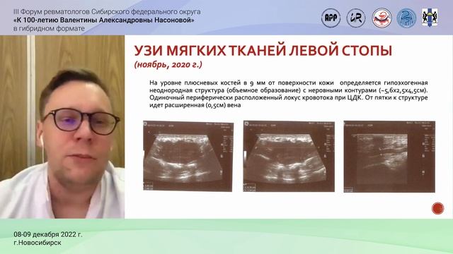 III Форум ревматологов Сибирского федерального округа 8 декабря смотреть онлайн