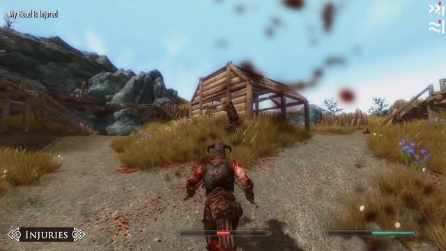 Skyrim Mod: Vigor - Combat & Injuries смотреть онлайн