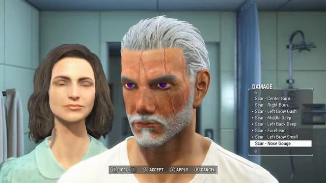 Description Of How Fallout Characters get Scars. смотреть онлайн