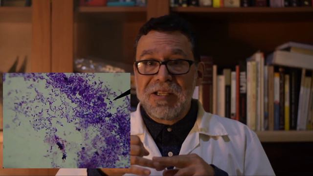 Otitis en perros: causas смотреть онлайн