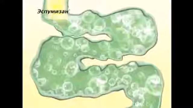 Реклама - Эспумизан . Для детей . смотреть онлайн