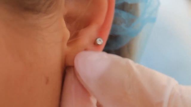 Прокол ушей Стадекс смотреть онлайн